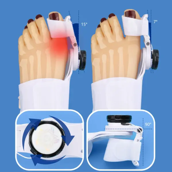 Sde29e141e3624852a9b3b812e12e5652R Bunion Corrector